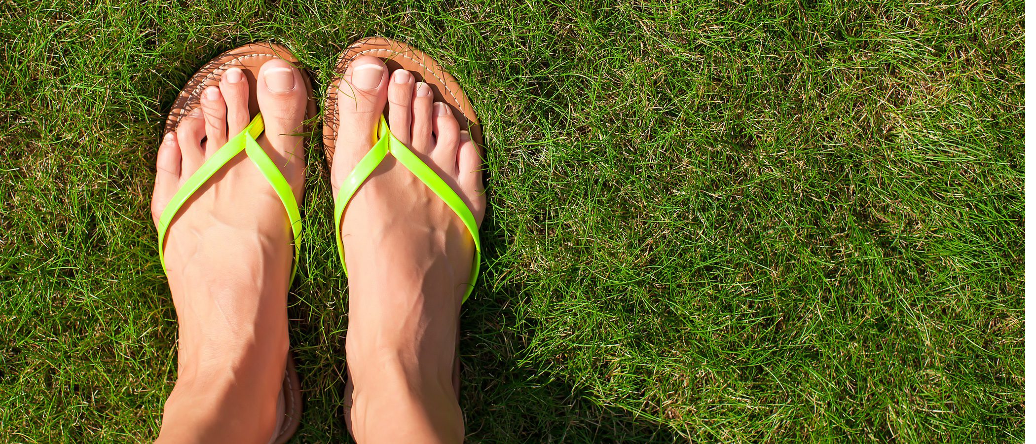 Chanclas en verano: cuándo usarlas y cuándo no